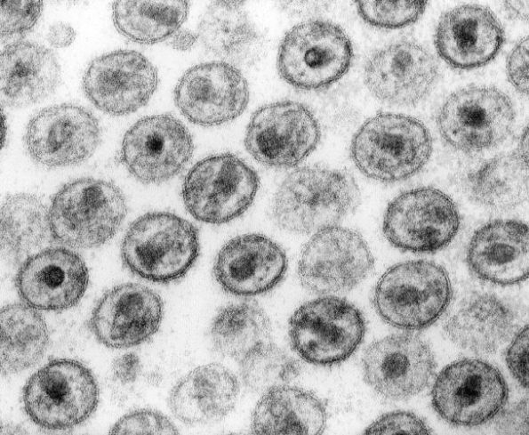 Desarrollan una vacuna experimental que genera anticuerpos del VIH en ratones