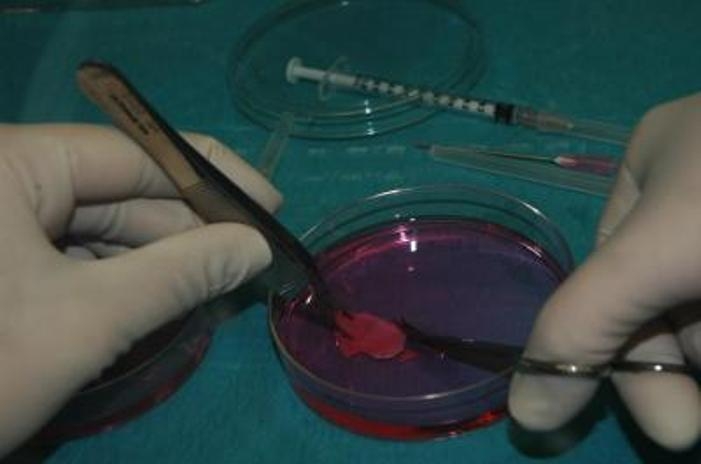 Mujer da a luz un bebé sano luego de pionero trasplante de ovario